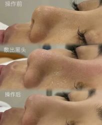 -春田皮肤管理中心品牌旗舰店