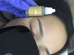 点击看大图 -郡艺医疗美容·微整·眼鼻吸脂