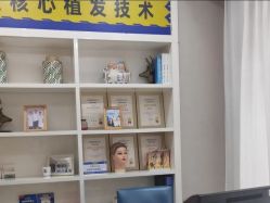 -大麦微针植发丨全国连锁