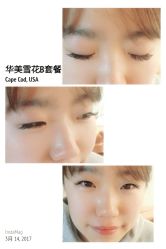 睫毛嫁接-光SPA科技美肤