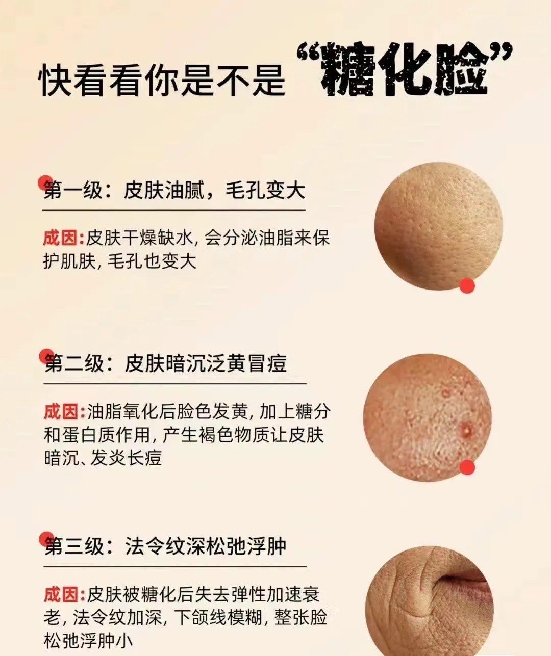 皮肤糖化是指肌肤因为过度摄入糖分,导致皮肤中的胶原蛋白和弹性纤维