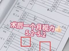 -黑马眼科·近视手术