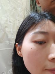 点击看大图 -痣缘宫