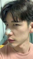 -北京米扬丽格医疗美容·联合丽格鼻整形中心
