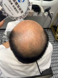 -唐风采假发补发定制