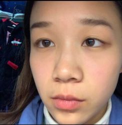 -深圳悦她医疗美容