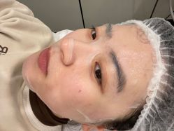 点击看大图 -爱小熊轻医美