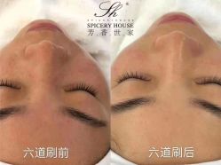 -SH芳香世家皮肤管理