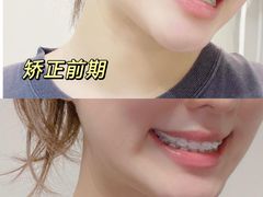 -极光口腔·矫正种植修复(锦江店)