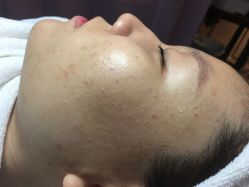 -皇族养心堂·净痘·修敏·御颜