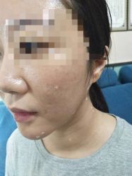 -北京美痣堂古方祛痣斑疣瘊