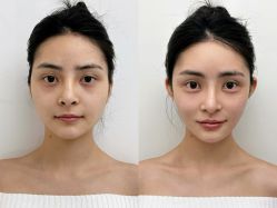 -韩辰医疗整形美容医院