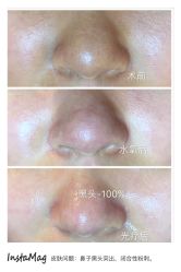 光SPA水氧+opt-光SPA科技美肤