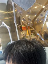 -碧莲盛·不剃发植发
