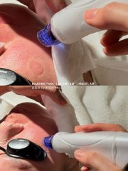 点击看大图 -韩国淼美颜皮肤管理官方直营店