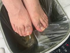 -世龙世家灰指甲·甲沟炎·跖疣护理·修脚(东江湾路店)