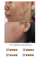 -E.beauty驻颜·痘敏肌调理中心