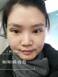 -八大处整形