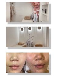 -苗方清颜痘肌研究所