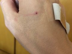 3个小时后拍的照片，当时划痕更长更明显-艾米茉亲子餐厅(万象城店)