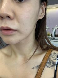 -小忠丽格医美