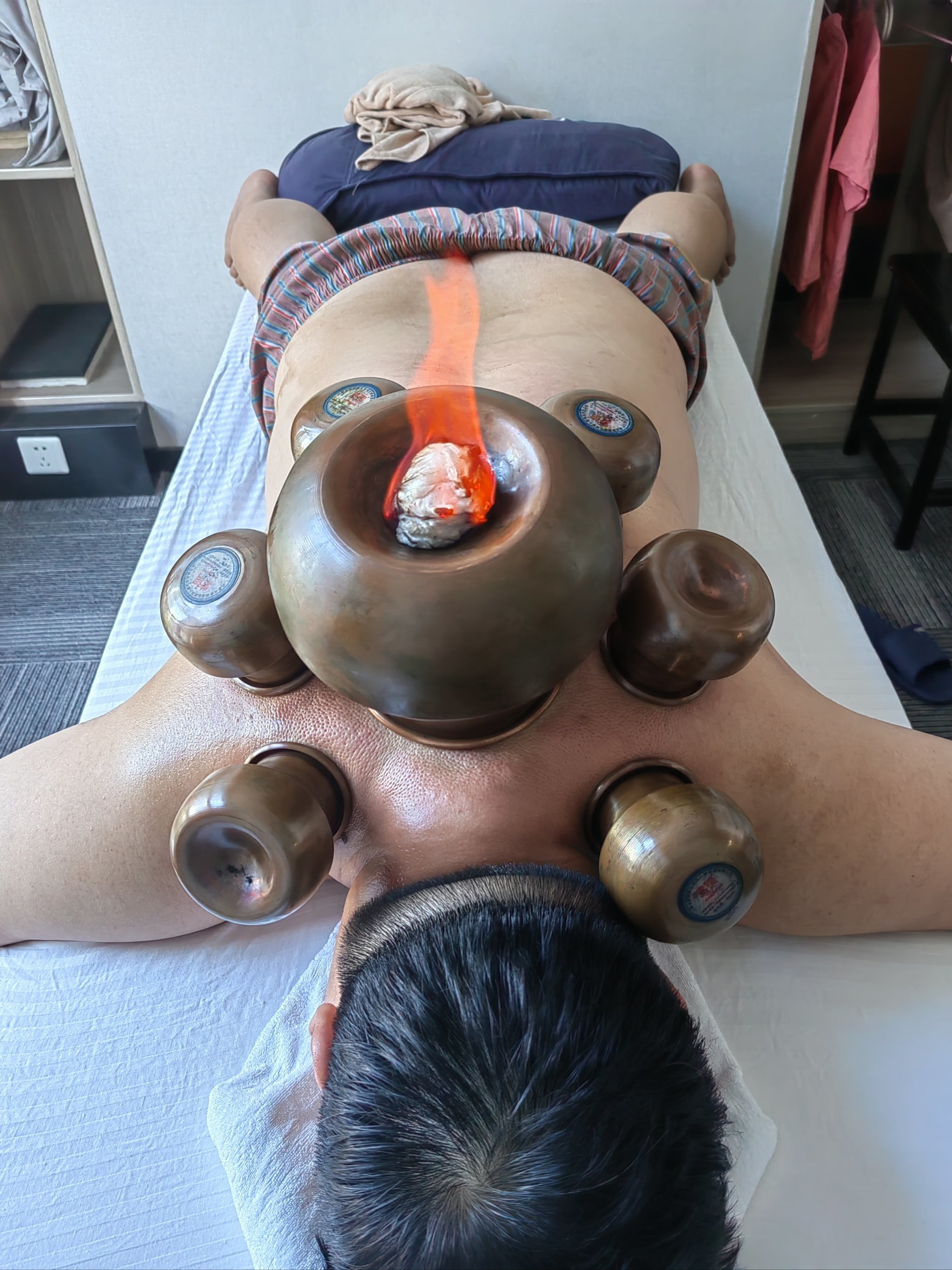 拔罐有祛风排湿,散郁结,祛火,扶阳罐有排寒暖宫等功效