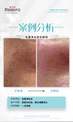 -黎蓓露·徒手骨雕蛋白抗衰·调肤管理