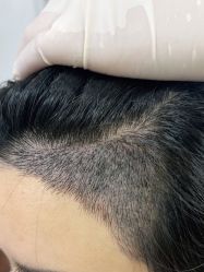 -熙朵美学植发·连锁品牌