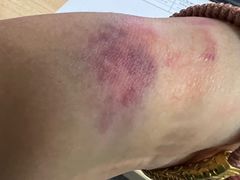 -瑞慈体检上海普陀机构