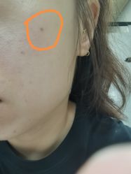 体验前-正璞医疗美容·皮肤修复·微整注射