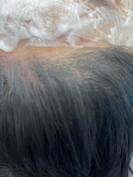 -熙朵美学植发·连锁品牌