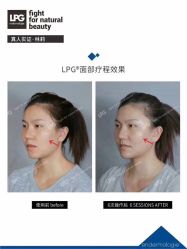 -克丽缇娜