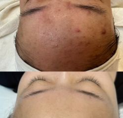 -SOS修丽可.痘肌修复中心