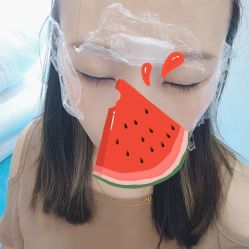 体验前-More摩尔医美の注射线雕光电中心