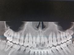 -优诺口腔·VIP尊享中心(爱建机构)