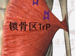 -通透堂中医·精准推拿(旗舰店)