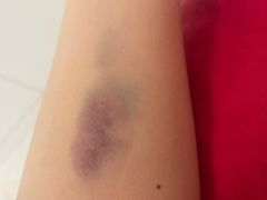 -中国人民解放军总医院