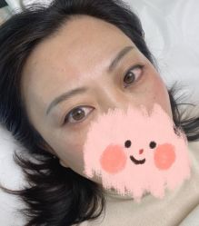 -Doris多里斯半永久纹眉·SMP纹发·发际线