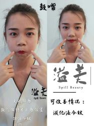 -溢美古法抗衰