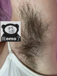 -薇兰专业脱毛连锁机构