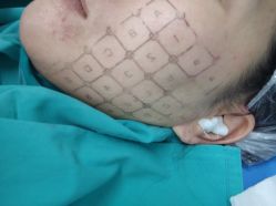 -北京八大处第二医疗美容医院