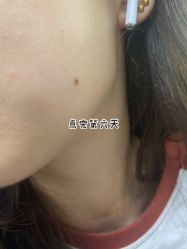 点击看大图 -小忠丽格医美