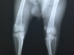 双侧髌骨内脱-佳怡动物医院·平价24小时·猫专科骨外科