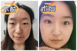 -素美医疗美容·西南眼鼻整形·修复基地