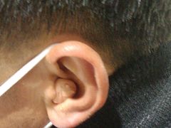 -自然之声助听器·呼吸机(贵定店)