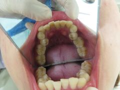 -宁波壹加壹口腔·矫正种植中心
