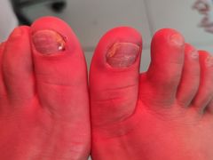 -新甲连锁灰指甲·甲沟炎·鸡眼(黑龙江路店)