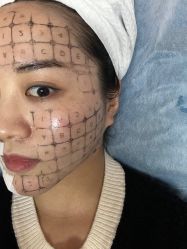 -小忠丽格医美