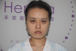 体验前-禾美嘉医疗美容