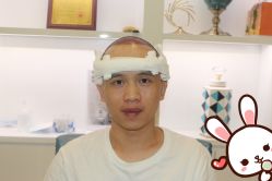 点击看大图 -大麦微针植发丨全国连锁